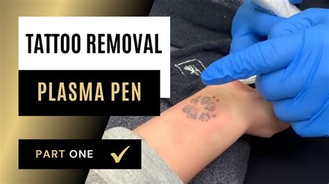 tattoo not leaking plasma|Everything You Need to Know About Plasma 